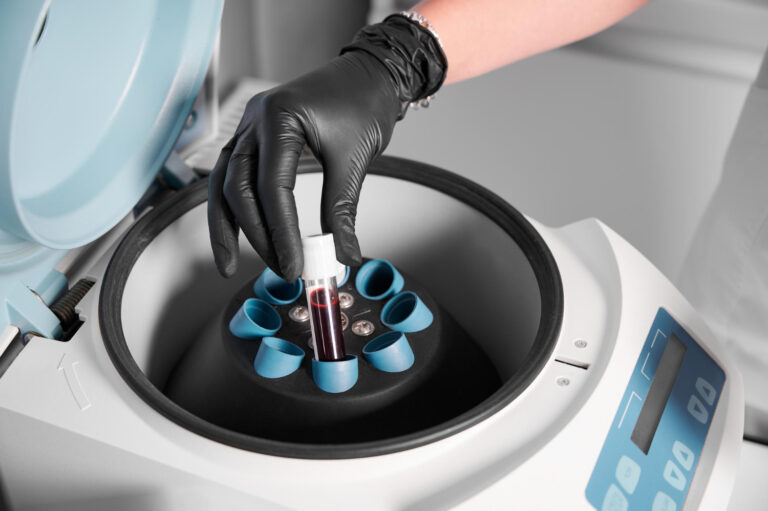 Platelet-Rich Plasma (PRP) Therapy: History, Uses, and Evidence 1 centrifuge separating platelet rich plasma from blood components in West Island QC by dr Nessrine Sabri